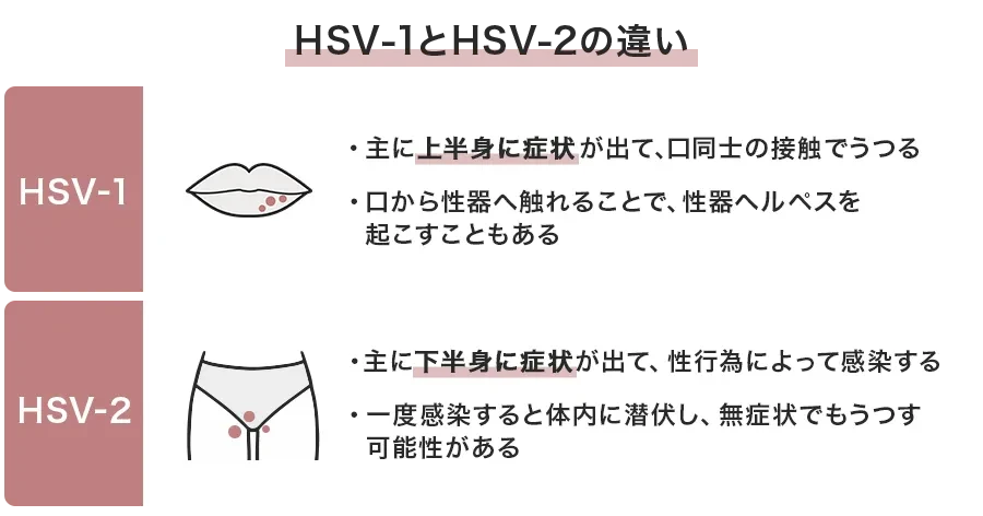 性器ヘルペスと口唇ヘルペスの違い