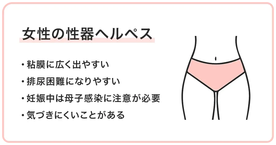 女性の性器ヘルペス