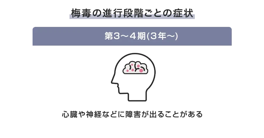 第3期~第4期(晩期梅毒の特徴)とは何か