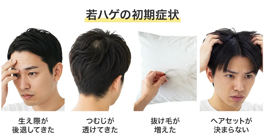 若ハゲによく見られる4つの初期症状