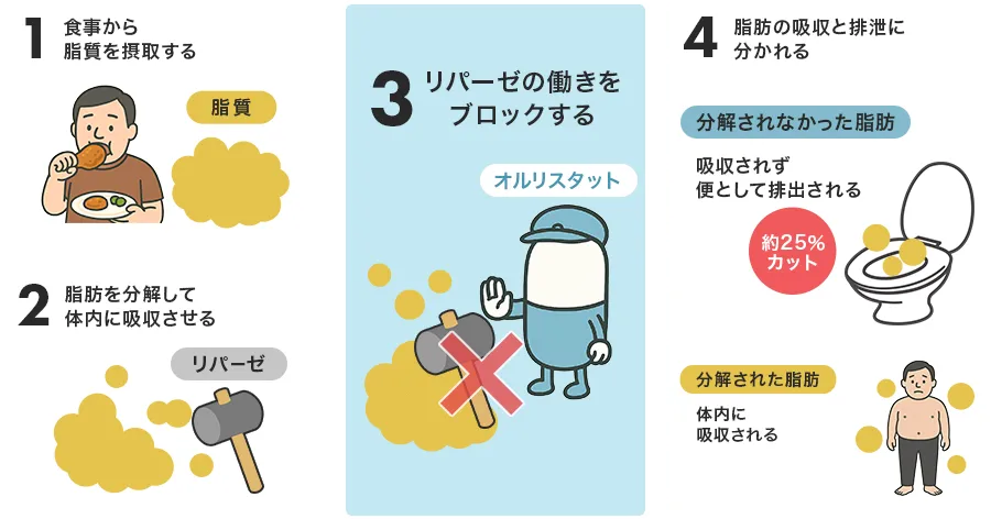 オルリスタットの作用機序とは?