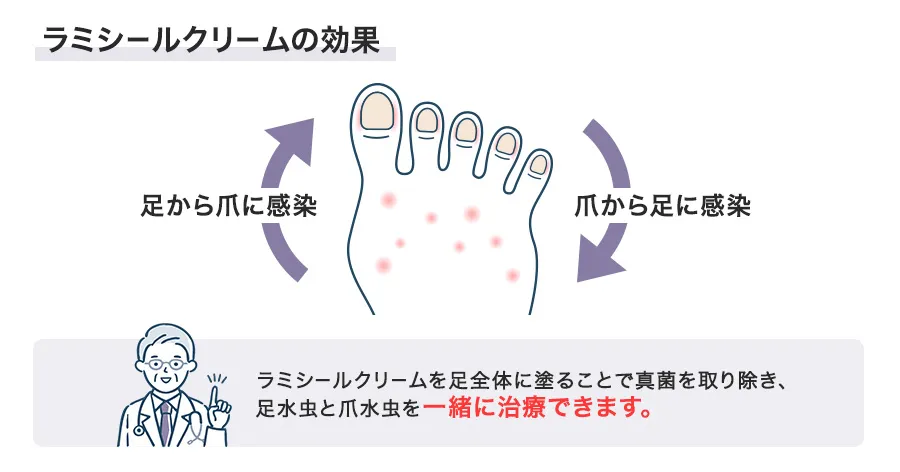 ラミシールクリームの効果