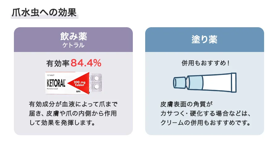 ケトラルの爪水虫への効果