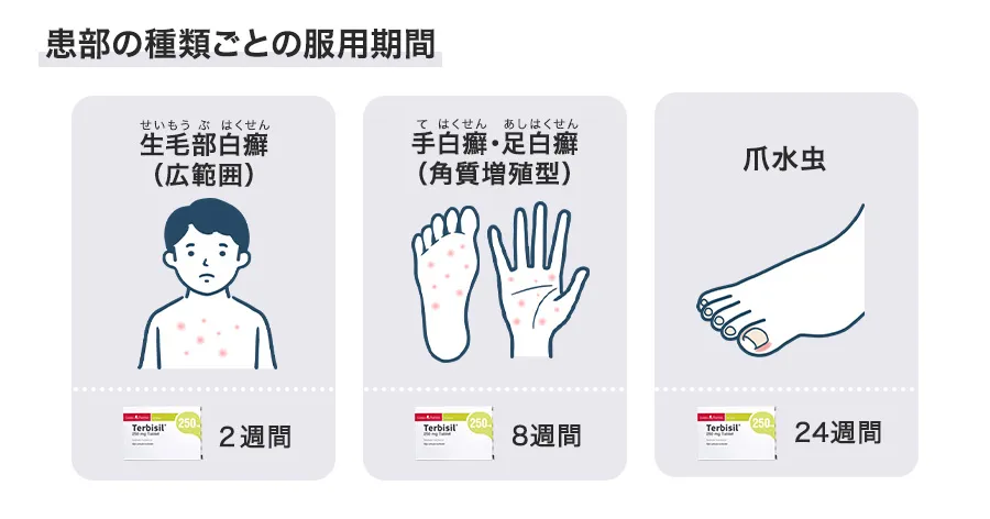 テルビシルの症状ごとの服用期間