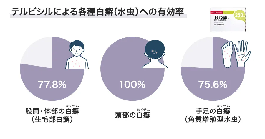 テルビシルの各種白癬への効果