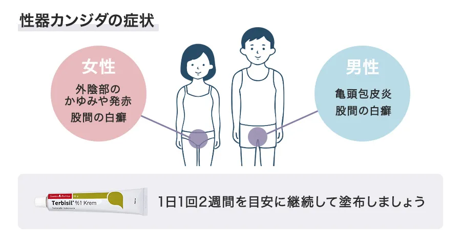 性器カンジダの症状