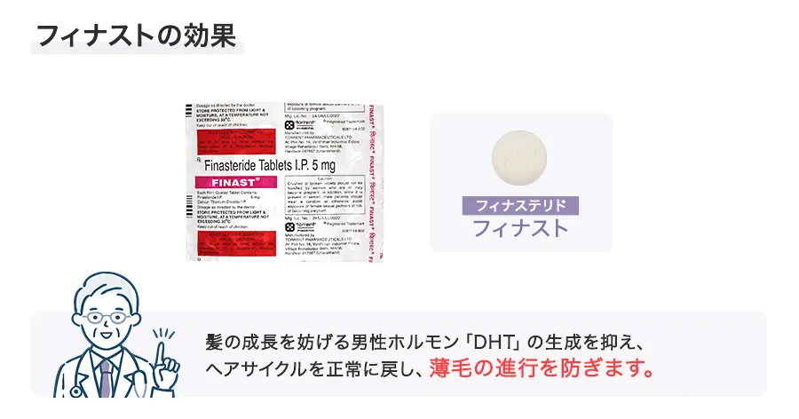 フィナストの効果